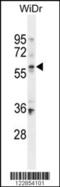 Beta,beta-carotene 15,15 -monooxygenase antibody, 55-200, ProSci, Western Blot image 