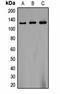 Calcium Voltage-Gated Channel Auxiliary Subunit Alpha2delta 2 antibody, orb323234, Biorbyt, Western Blot image 
