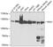 PKN1 antibody, 13-202, ProSci, Western Blot image 