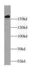 DCC Netrin 1 Receptor antibody, FNab02262, FineTest, Western Blot image 