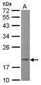 5', 3'-Nucleotidase, Cytosolic antibody, PA5-32058, Invitrogen Antibodies, Western Blot image 