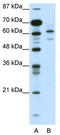 Zinc Finger And SCAN Domain Containing 2 antibody, TA332280, Origene, Western Blot image 