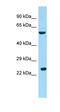 Regulator Of G Protein Signaling 9 Binding Protein antibody, orb326535, Biorbyt, Western Blot image 