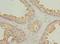 Galactosidase Beta 1 Like 2 antibody, A66082-100, Epigentek, Immunohistochemistry paraffin image 