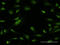 Zinc finger and BTB domain-containing protein 25 antibody, LS-C198469, Lifespan Biosciences, Immunofluorescence image 