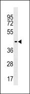 Zinc Finger Protein 662 antibody, PA5-49168, Invitrogen Antibodies, Western Blot image 