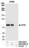 Glycogen Synthase 1 antibody, A304-238A, Bethyl Labs, Immunoprecipitation image 