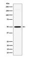 Cell surface A33 antigen antibody, M07688-1, Boster Biological Technology, Western Blot image 