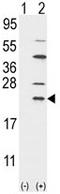 Ubiquitin-conjugating enzyme E2 C antibody, AP17818PU-N, Origene, Western Blot image 
