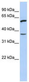 TNF Receptor Superfamily Member 21 antibody, TA341938, Origene, Western Blot image 