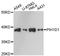 PIH1 Domain Containing 1 antibody, LS-C748753, Lifespan Biosciences, Western Blot image 