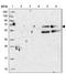 RNA Exonuclease 5 antibody, NBP1-92076, Novus Biologicals, Western Blot image 