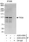 SH3 And PX Domains 2B antibody, A303-436A, Bethyl Labs, Immunoprecipitation image 