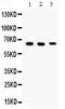 Internexin Neuronal Intermediate Filament Protein Alpha antibody, PB10003, Boster Biological Technology, Western Blot image 