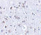 BR Serine/Threonine Kinase 1 antibody, 4081, ProSci, Immunohistochemistry paraffin image 