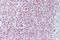 C-X-C Motif Chemokine Ligand 14 antibody, AVARP07023_P050, Aviva Systems Biology, Immunohistochemistry paraffin image 
