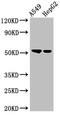 Glucosaminyl (N-Acetyl) Transferase 3, Mucin Type antibody, orb400456, Biorbyt, Western Blot image 