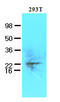 Ubiquitin-conjugating enzyme E2 S antibody, AM09138PU-S, Origene, Western Blot image 