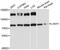 La Ribonucleoprotein Domain Family Member 4B antibody, LS-C748142, Lifespan Biosciences, Western Blot image 
