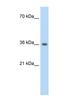 Phytanoyl-CoA 2-Hydroxylase Interacting Protein antibody, NBP1-56325, Novus Biologicals, Western Blot image 