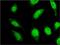 Uncharacterized protein C18orf23 antibody, H00147341-M01, Novus Biologicals, Immunofluorescence image 