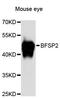 Beaded Filament Structural Protein 2 antibody, LS-C748118, Lifespan Biosciences, Western Blot image 