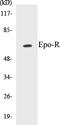 Erythropoietin Receptor antibody, EKC1197, Boster Biological Technology, Western Blot image 