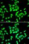 ANTXR Cell Adhesion Molecule 1 antibody, LS-B13896, Lifespan Biosciences, Immunofluorescence image 