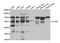 5-Hydroxytryptamine Receptor 2B antibody, TA332831, Origene, Western Blot image 