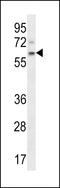 APC Down-Regulated 1 antibody, 57-008, ProSci, Western Blot image 