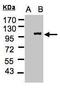 Lgl2 antibody, GTX107982, GeneTex, Western Blot image 