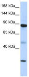 Putative ATP-dependent RNA helicase TDRD9 antibody, TA341630, Origene, Western Blot image 