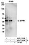 Mitochondrial Fission Regulator 1 antibody, A305-715A-M, Bethyl Labs, Immunoprecipitation image 