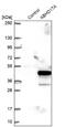 Abhydrolase Domain Containing 17A antibody, NBP2-31029, Novus Biologicals, Western Blot image 