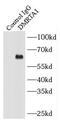 Doublesex- and mab-3-related transcription factor A1 antibody, FNab02426, FineTest, Immunoprecipitation image 