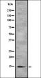 Interleukin 12 Receptor Subunit Beta 2 antibody, orb335319, Biorbyt, Western Blot image 
