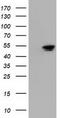 5'-Nucleotidase Domain Containing 1 antibody, LS-C115540, Lifespan Biosciences, Western Blot image 