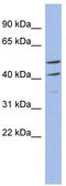 Myb Related Transcription Factor, Partner Of Profilin antibody, TA330048, Origene, Western Blot image 