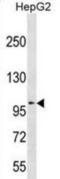 Alpha-mannosidase 2C1 antibody, abx031182, Abbexa, Western Blot image 
