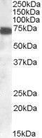 Zinc Finger DHHC-Type Containing 13 antibody, PA5-18341, Invitrogen Antibodies, Western Blot image 