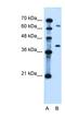 Leucine Rich Repeat Containing 26 antibody, NBP1-70485, Novus Biologicals, Western Blot image 