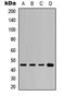 Keratin 20 antibody, LS-B13607, Lifespan Biosciences, Western Blot image 