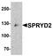 Cardiomyopathy Associated 5 antibody, NBP1-77117, Novus Biologicals, Western Blot image 