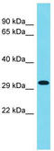 G-Patch Domain Containing 11 antibody, TA334822, Origene, Western Blot image 