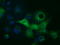 Sterol O-Acyltransferase 2 antibody, LS-C115245, Lifespan Biosciences, Immunofluorescence image 