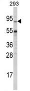 ATP Binding Cassette Subfamily G Member 1 antibody, AP17071PU-N, Origene, Western Blot image 