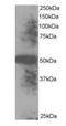 EndoPDI antibody, orb18685, Biorbyt, Western Blot image 