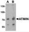 ATM Interactor antibody, NBP2-81796, Novus Biologicals, Western Blot image 