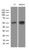 LIM Homeobox 2 antibody, M05940-1, Boster Biological Technology, Western Blot image 