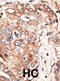 TPX2 Microtubule Nucleation Factor antibody, abx031502, Abbexa, Western Blot image 
